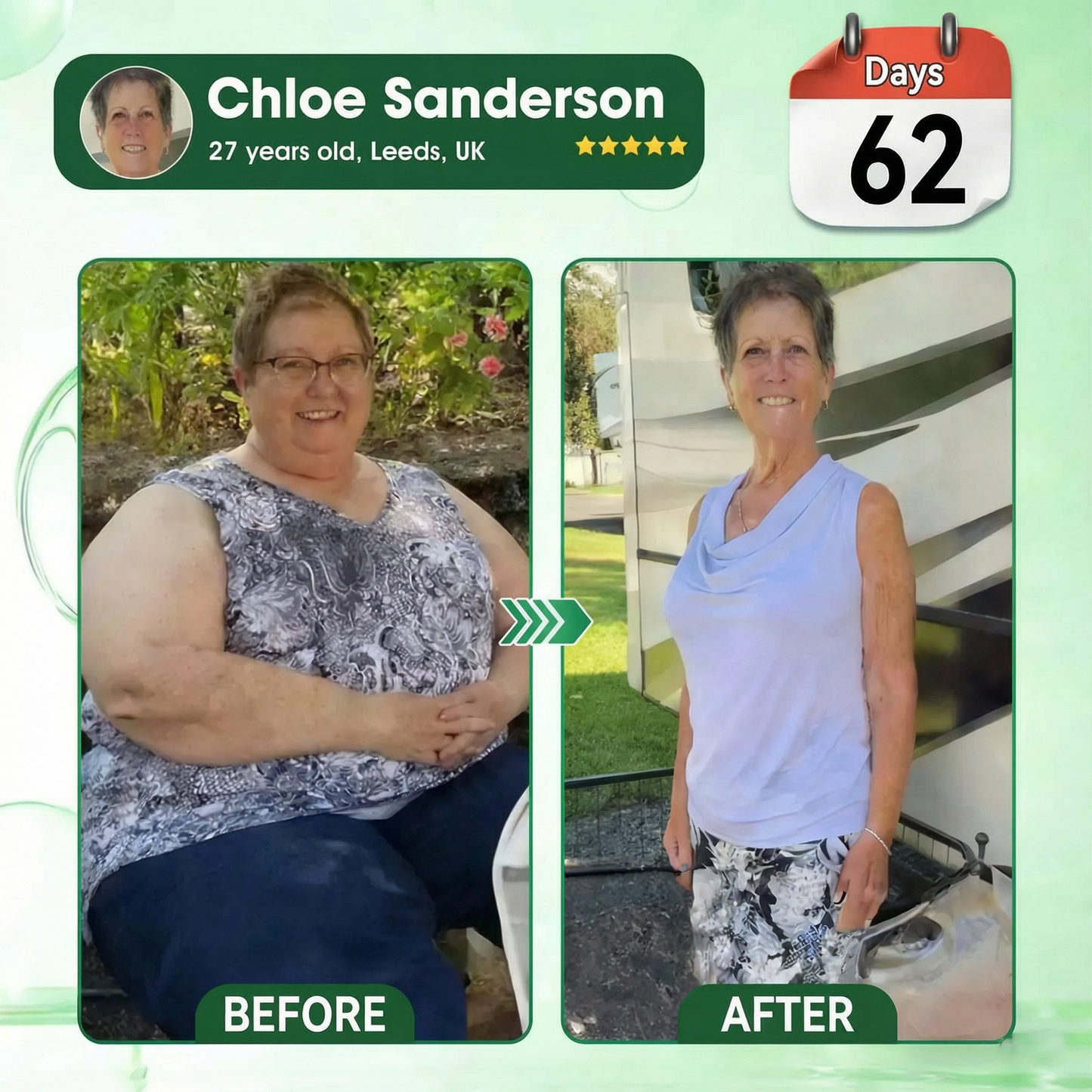 LOVILDS™ Moringa · Berberine × NAD+ 𝟏𝟎-𝐢𝐧-𝟏 𝐀𝐝𝐯𝐚𝐧𝐜𝐞𝐝 𝐍𝐚𝐧𝐨 𝐌𝐢𝐜𝐫𝐨𝐧𝐞𝐞𝐝𝐥𝐞 𝐏𝐚𝐭𝐜𝐡 — 𝐎𝐧𝐜𝐞 𝐃𝐚𝐢𝐥𝐲, 𝐕𝐢𝐬𝐢𝐛𝐥𝐞 𝐑𝐞𝐬𝐮𝐥𝐭𝐬 𝐢𝐧 𝟕 𝐃𝐚𝐲𝐬